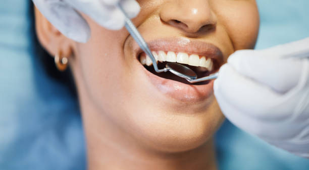 Best Broken or Chipped Tooth Repair in New Port Richey East, FL